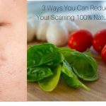 scarring natural ideas
